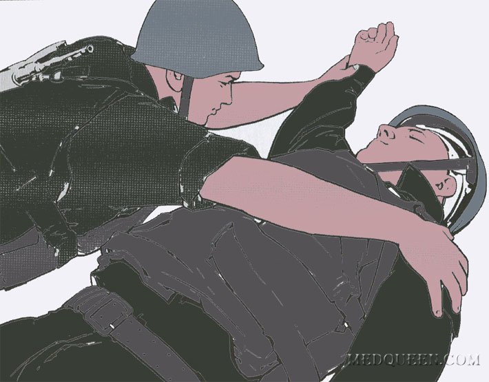 Перевод раненного в положение на бок (живот) Перевод раненного в положение на бок (живот)