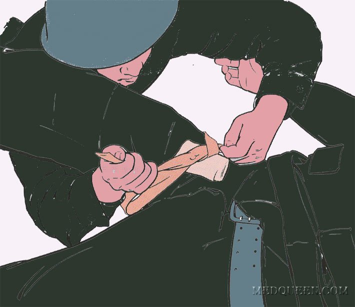 Остановка кровотечения из раны нижней конечности (взаимопомощь) Остановка кровотечения из раны нижней конечности (взаимопомощь)