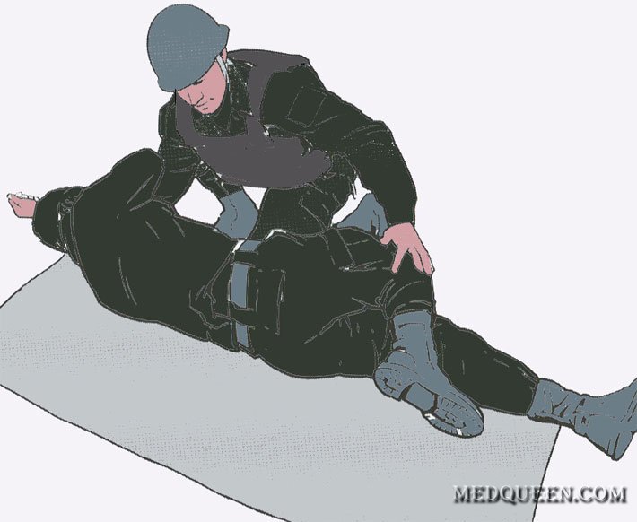 Переведение раненного в Стабильное положение Переведение раненного в Стабильное положение