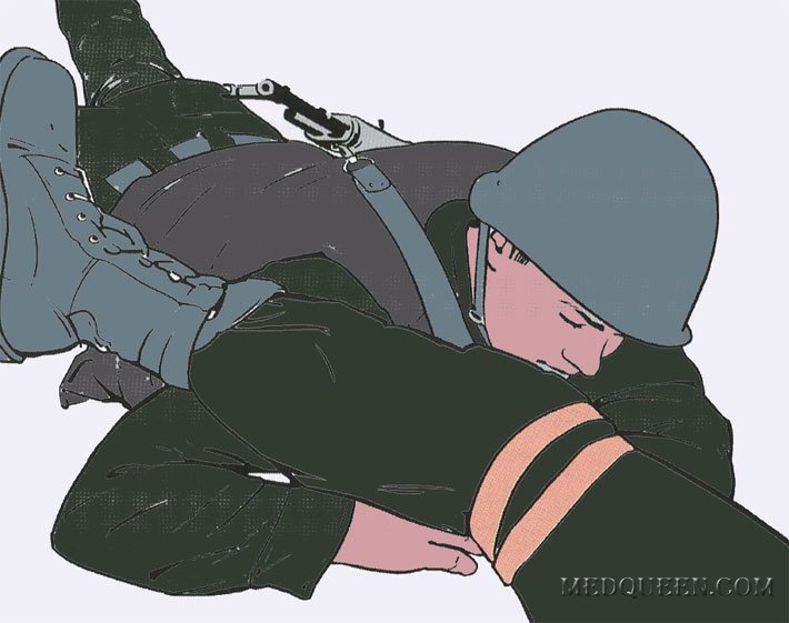 Остановка кровотечения из раны нижней конечности (взаимопомощь) Остановка кровотечения из раны нижней конечности (взаимопомощь)