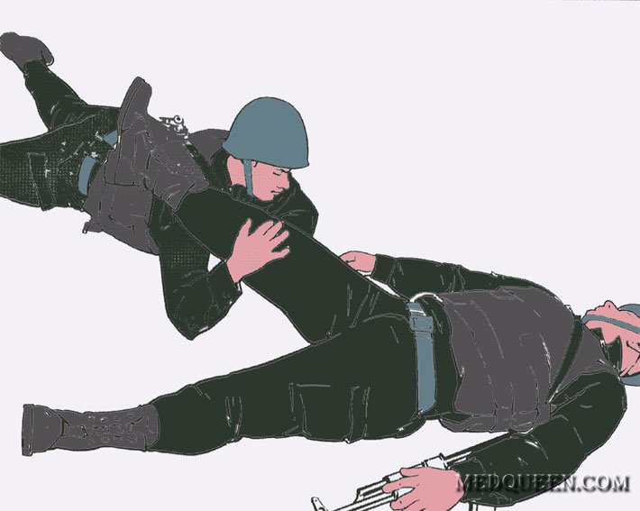 Остановка кровотечения из раны нижней конечности (взаимопомощь) Остановка кровотечения из раны нижней конечности (взаимопомощь)