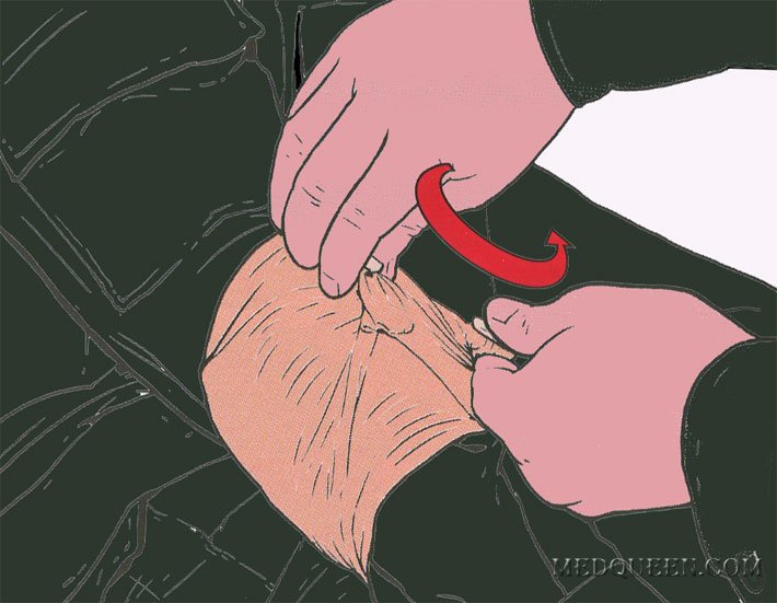 ОСТАНОВКА КРОВОТЕЧЕНИЯ ИЗ РАНЫ КОНЕЧНОСТИ ПРИ ПОМОЩИ СПЕЦИАЛЬНЫХ ПЕРЕВЯЗОЧНЫХ ПАКЕТОВ ОСТАНОВКА КРОВОТЕЧЕНИЯ ИЗ РАНЫ КОНЕЧНОСТИ ПРИ ПОМОЩИ СПЕЦИАЛЬНЫХ ПЕРЕВЯЗОЧНЫХ ПАКЕТОВ