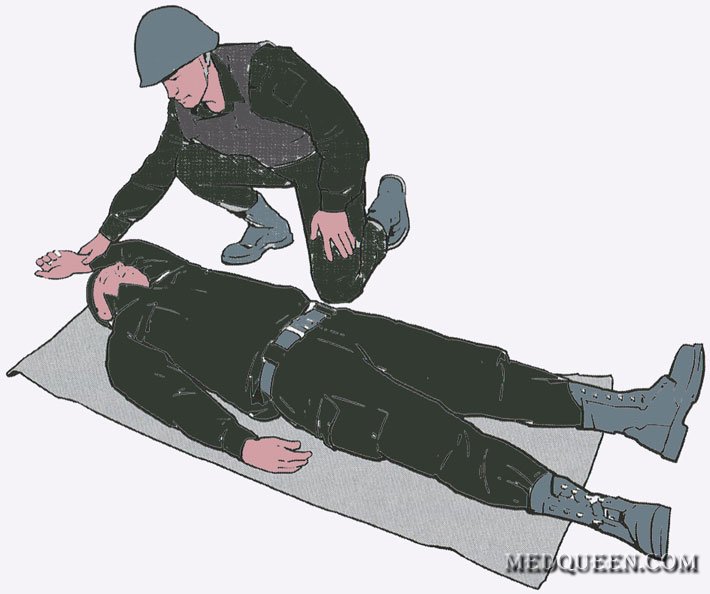 Переведение раненного в Стабильное положение Переведение раненного в Стабильное положение