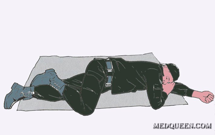 Переведение раненного в Стабильное положение Переведение раненного в Стабильное положение