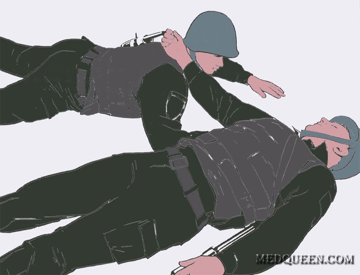 Остановка кровотечения из раны верхней конечности (взаимопомощь) Остановка кровотечения из раны верхней конечности (взаимопомощь)