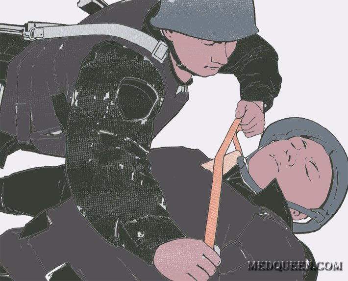 Остановка внешнего кровотечения из раны шеи Остановка внешнего кровотечения из раны шеи