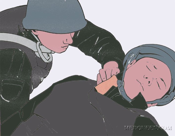 Остановка внешнего кровотечения из раны шеи Остановка внешнего кровотечения из раны шеи