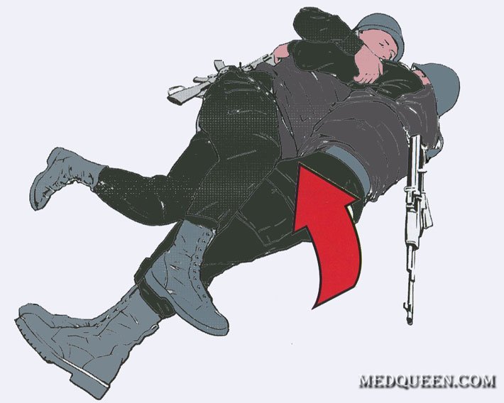 ТРАНСПОРТИРОВКА (ПЕРЕМЕЩЕНИЕ) РАНЕННОГО В СЕКТОР УКРЫТИЯ ТРАНСПОРТИРОВКА (ПЕРЕМЕЩЕНИЕ) РАНЕННОГО В СЕКТОР УКРЫТИЯ