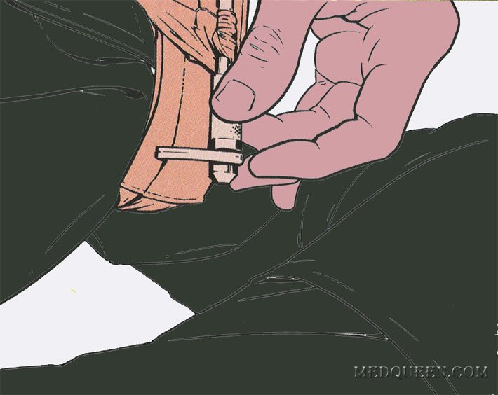 Остановка кровотечения при помощи специальных жгутов (самопомощь) Остановка кровотечения при помощи специальных жгутов (самопомощь)