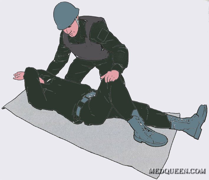 Переведение раненного в Стабильное положение Переведение раненного в Стабильное положение