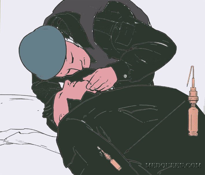 ВВЕДЕНИЕ ОБЕЗБОЛИВАЮЩИХ СРЕДСТВ ПРИ ПОМОЩИ ШПРИЦ-ТЮБИКА ВВЕДЕНИЕ ОБЕЗБОЛИВАЮЩИХ СРЕДСТВ ПРИ ПОМОЩИ ШПРИЦ-ТЮБИКА