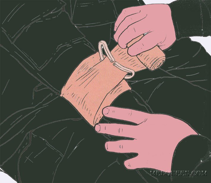 ОСТАНОВКА КРОВОТЕЧЕНИЯ ИЗ РАНЫ КОНЕЧНОСТИ ПРИ ПОМОЩИ СПЕЦИАЛЬНЫХ ПЕРЕВЯЗОЧНЫХ ПАКЕТОВ ОСТАНОВКА КРОВОТЕЧЕНИЯ ИЗ РАНЫ КОНЕЧНОСТИ ПРИ ПОМОЩИ СПЕЦИАЛЬНЫХ ПЕРЕВЯЗОЧНЫХ ПАКЕТОВ