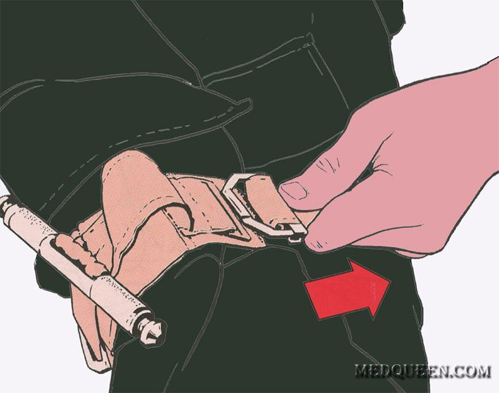 Остановка кровотечения при помощи специальных жгутов (самопомощь) Остановка кровотечения при помощи специальных жгутов (самопомощь)