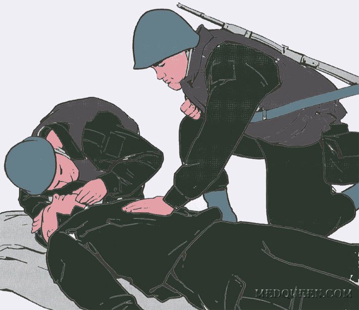 Первичный осмотр раненного, определение признаков жизни Первичный осмотр раненного, определение признаков жизни