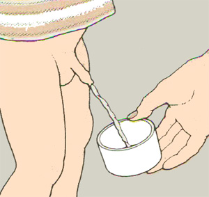 Сбор анализа мочи у мальчиков Сбор анализа мочи у мальчиков