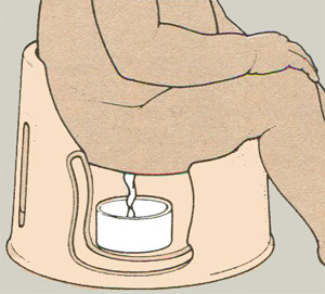 Сбор анализа мочи у девочек Сбор анализа мочи у девочек