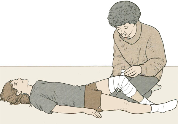 Наложение повязки при травме колена Наложение повязки при травме колена