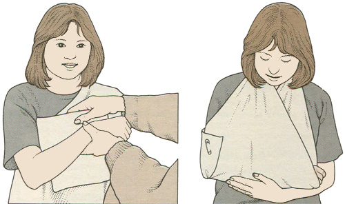 Фиксация руки при травме предплечья Фиксация руки при травме предплечья