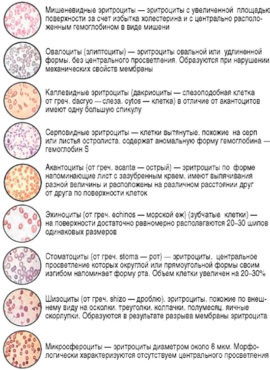Оценка морфологических параметров эритроцитов Оценка морфологических параметров эритроцитов