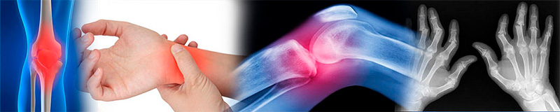 Боль в суставах Боль в суставах