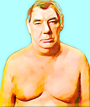 Синдром верхней полой вены Синдром верхней полой вены