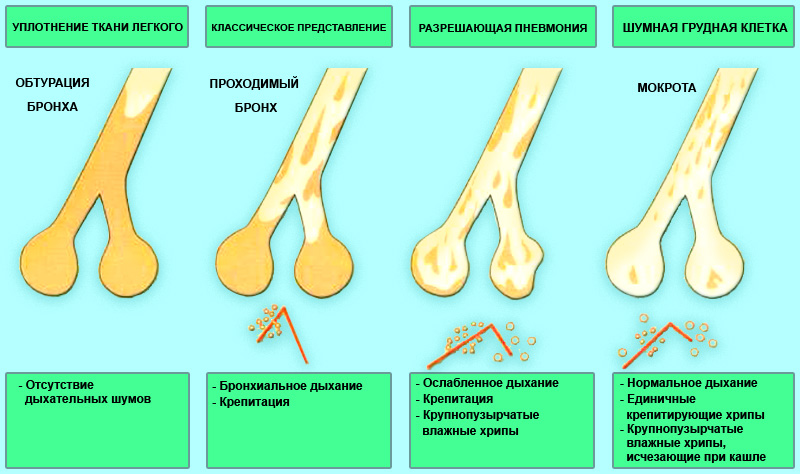 Аускультация Аускультация
