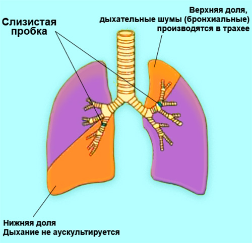 Аускультация Аускультация
