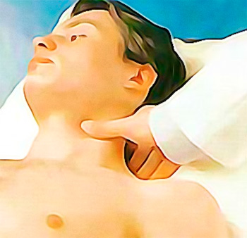 Митральная бабочка на лице Митральная бабочка на лице