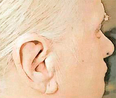 Складка Франка Складка Франка