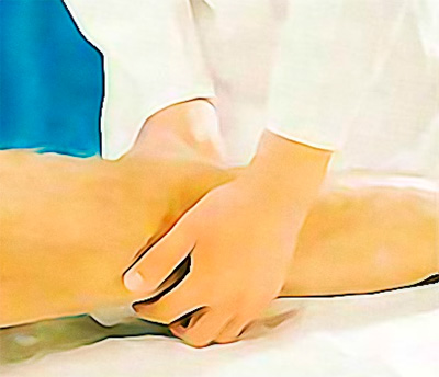 Пальпация подколенной артерии Пальпация подколенной артерии