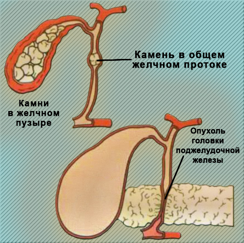 Закон Курвуазье Закон Курвуазье