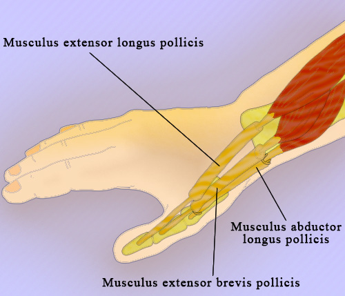 Стенозирующий тендовагинит Стенозирующий тендовагинит
