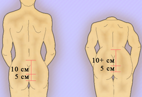 Тест Шобера Тест Шобера