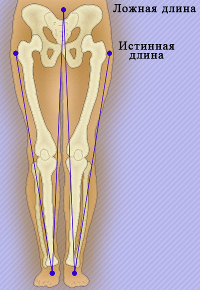 Тазобедренные суставы Тазобедренные суставы