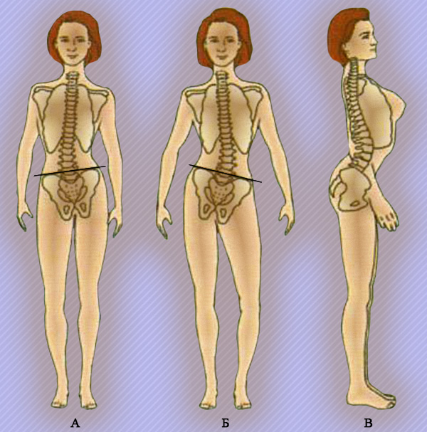 Тазобедренные суставы Тазобедренные суставы