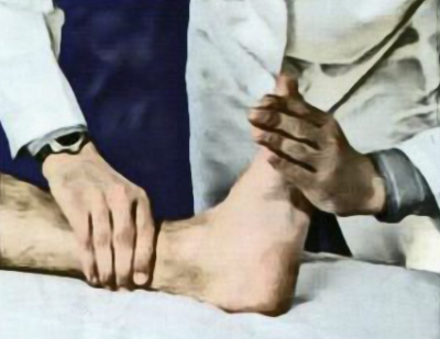 Исследование клонуса стопы Исследование клонуса стопы