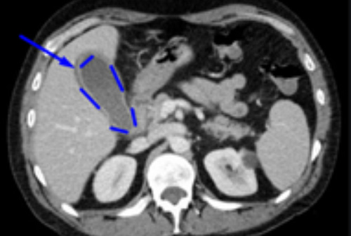 Компьютерная томография Компьютерная томография