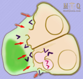 Активация трипсиногена Активация трипсиногена