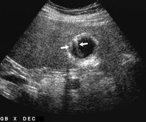 Артефакт «Хвост кометы» Артефакт «Хвост кометы»