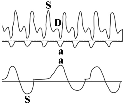 Допплерография нижней полой вены Допплерография нижней полой вены