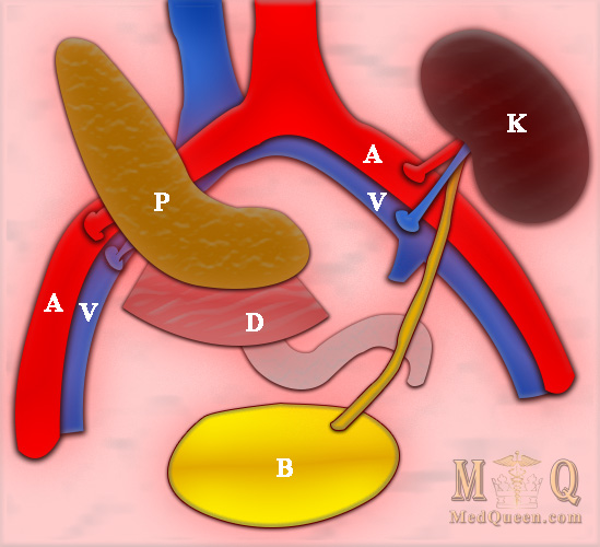 Комбинированная трансплантация почки и поджелудочной железы Комбинированная трансплантация почки и поджелудочной железы