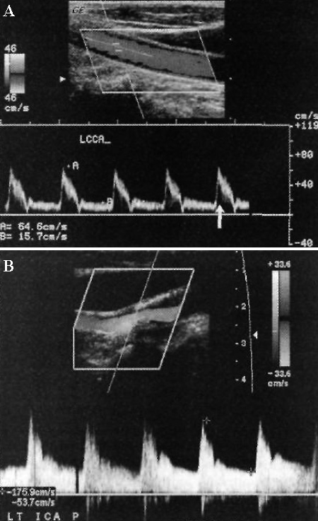 УЗИ: Спектральное расширение УЗИ: Спектральное расширение