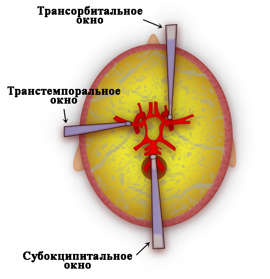 Акустические окна для транскраниальной допплерографии Акустические окна для транскраниальной допплерографии