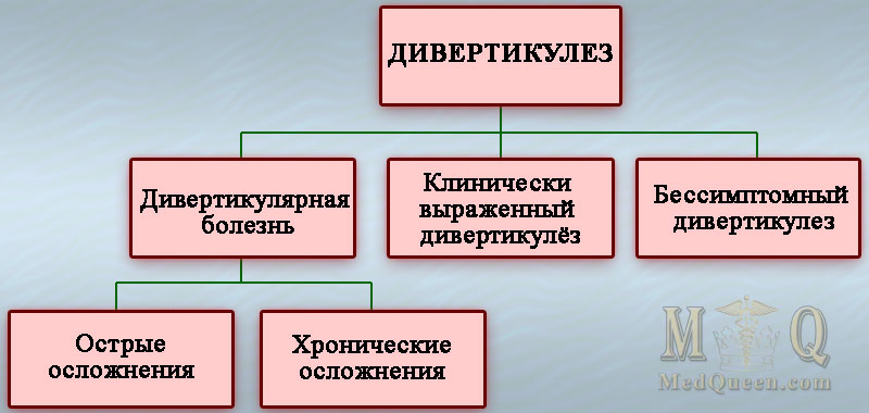 Дивертикулез Дивертикулез