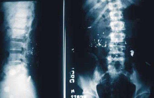 Разрушение пули и «свинцовый дождь» Разрушение пули и «свинцовый дождь»