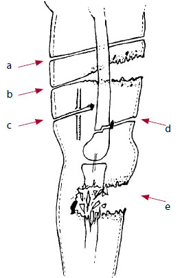 Примеры оценки ран в баллах Примеры оценки ран в баллах
