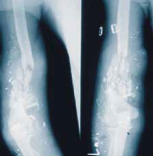 «Свинцовый дождь» «Свинцовый дождь»