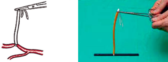 Турникет Руммеля Турникет Руммеля